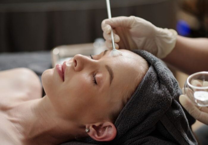 chemical peels